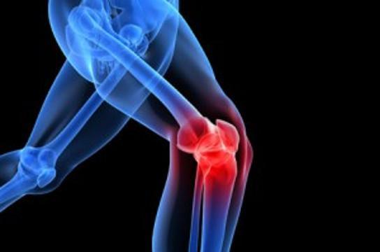 Pesquisa avalia ação da osteoartrite na musculatura do joelho. Foto: Reprodução