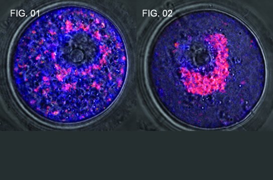 Fig 1: óvulo normal. Fig 2: óvulo que não expressa as proteínas Mnf1 e Mfn2. Foto: Pesquisa 