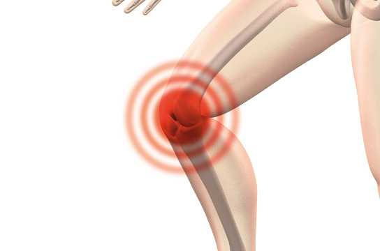 Pesquisa avalia terapias complementares e exercícios para tratar artrose de joelho (Foto: Pixabay)