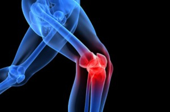 Pesquisas convidam voluntários para estudo sobre artrose de joelho. Foto: Reprodução
