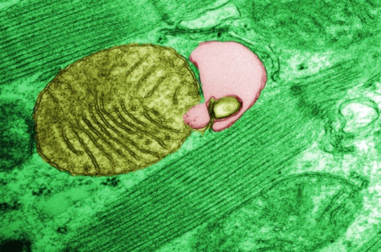 Mitocôndria sendo envolvida pelo autofagossomo (Julio C. B. Ferreira – ICB/USP)