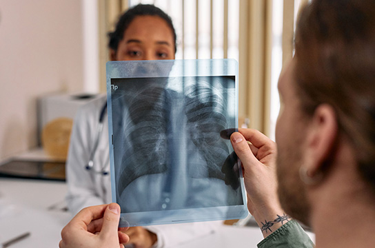 HU tem projeto sobre tuberculose aprovado na Rede HU+